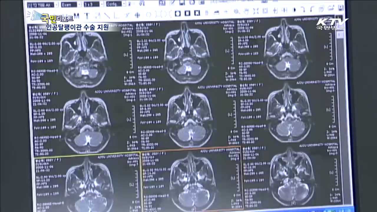 청각장애아동에게 '세상의 소리' 선물