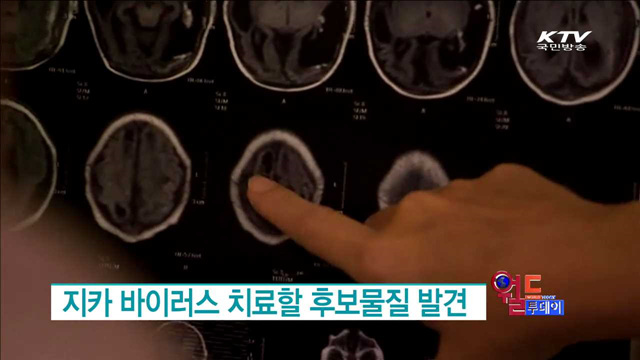 지카 바이러스 치료할 후보물질 발견 [월드 투데이]