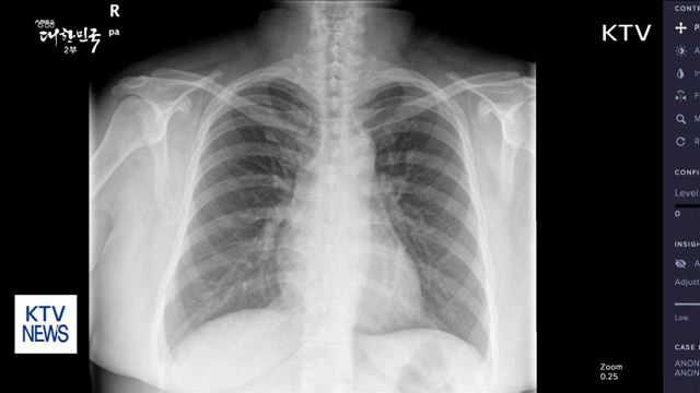 인공지능 시스템, 암 진단 정확성 높인다
