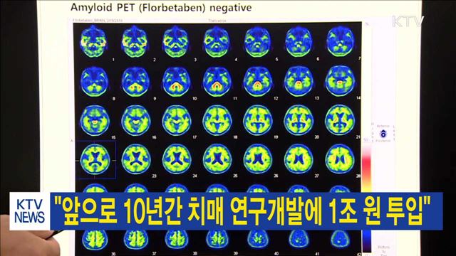 "앞으로 10년간 치매 연구개발에 1조 원 투입"