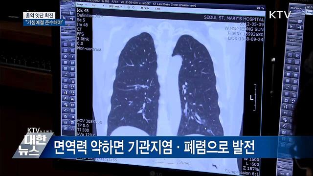 홍역 잇단 확진···"기침할 때 코·입 가려야"