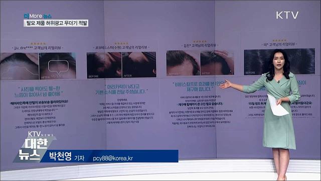 탈모 제품 허위·과대광고 2천248건 적발