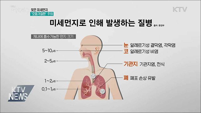 잦은 미세먼지···환절기 '호흡기질환' 주의