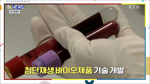 혈액 공급 체계 큰 변화 온다 [S&News]