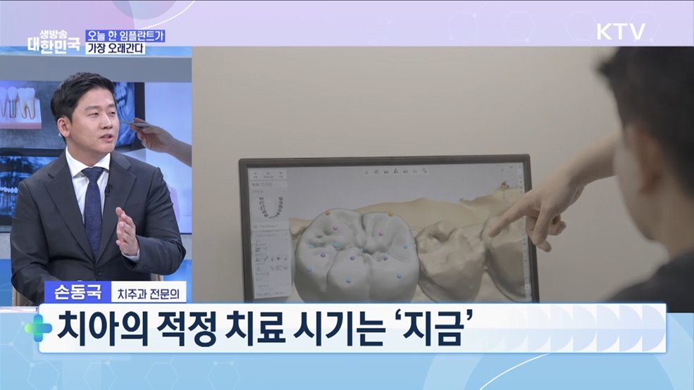 잘 심고 오래 쓴다! 실패 없는 임플란트 완벽가이드 [건강 365]