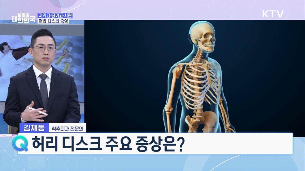 지긋지긋한 허리통증 디스크 극복 비결은? [건강 365]