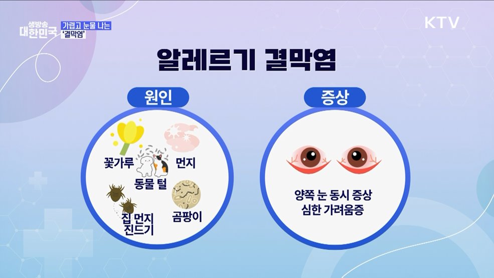 '봄철 건강관리 1편' 맑은 눈 되찾을 비법은? [건강 365]