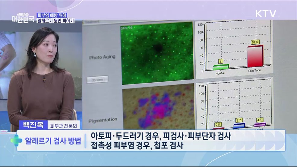 '봄철 건강관리 2편' 똑똑한 피부 질환 예방법 [건강 365]