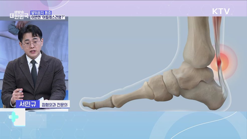 걷기만 해도 '찌릿한 통증'···봄철 발 질환 주의보! [건강 365]