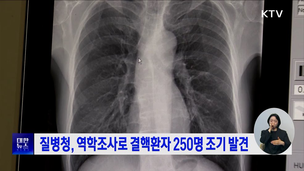 질병청, 역학조사로 결핵환자 250명 조기 발견