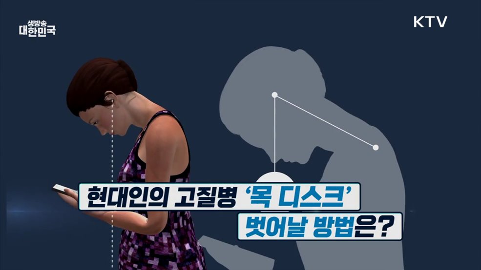 '두통, 팔·다리 마비까지?' 목 디스크 예방·관리법 [건강 365]