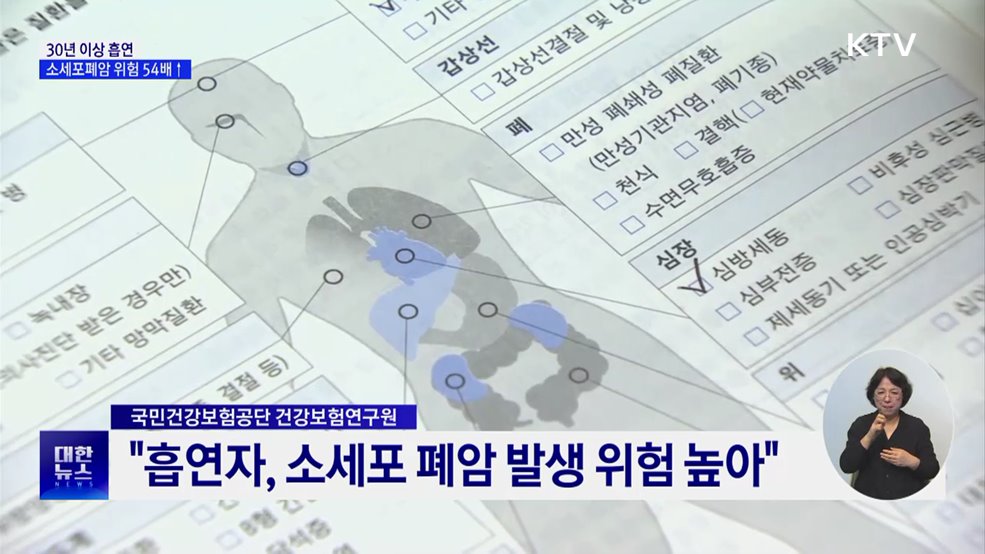 30년 이상 흡연하면 소세포폐암 위험 54배↑