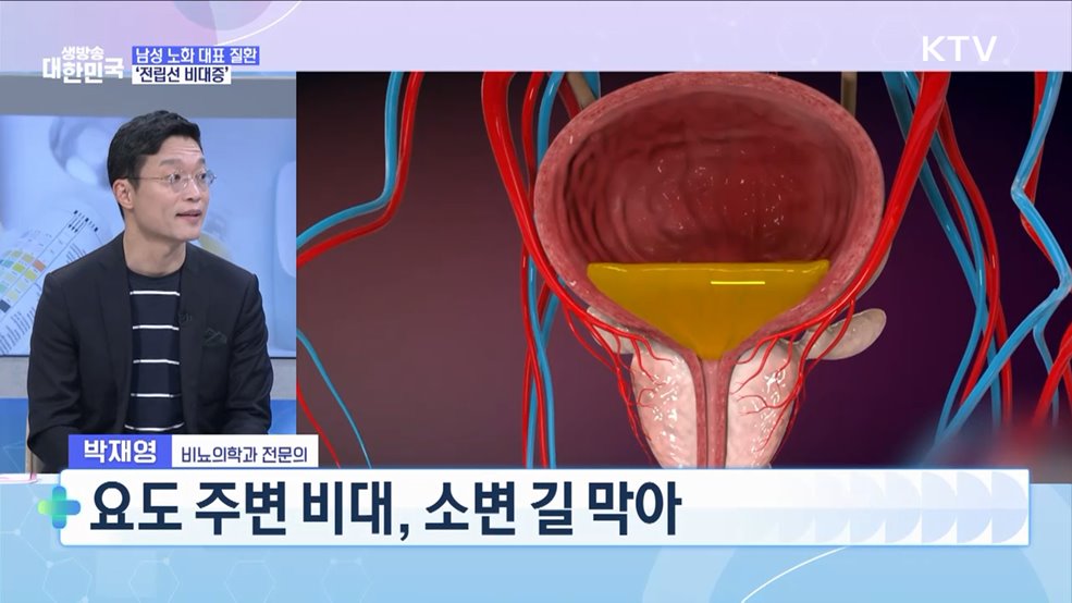 "소변보는 것이 두려워요" 중년 남성 절반 '전립선' 적신호!