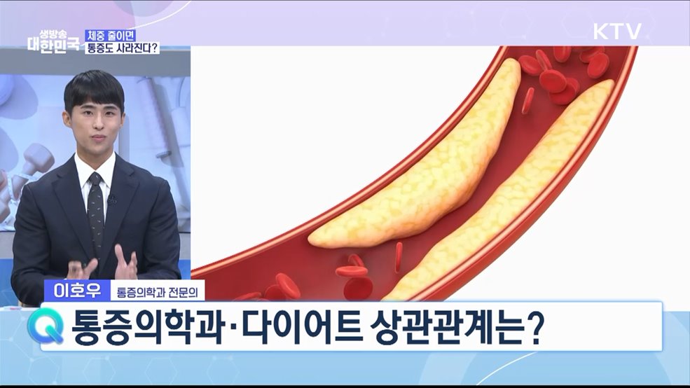 요요·관절 무리 없는 여름맞이 다이어트 비법 [건강 365]