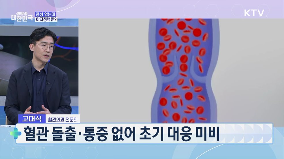 '울퉁불퉁 튀어나온 혈관' 하지정맥류 완전정복! [건강 365]