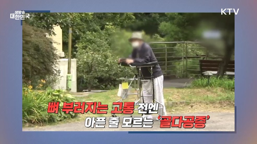 뼈 부러졌는데 사망까지 골다공증 예방·탈출 비법은? [건강 365]