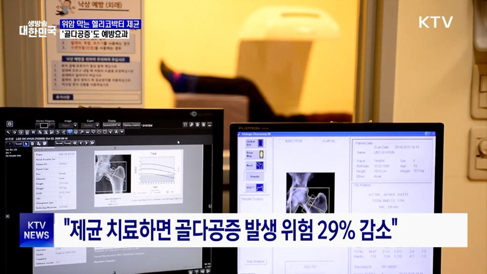 "골다공증 예방에 '헬리코박터 제균치료' 효과적"