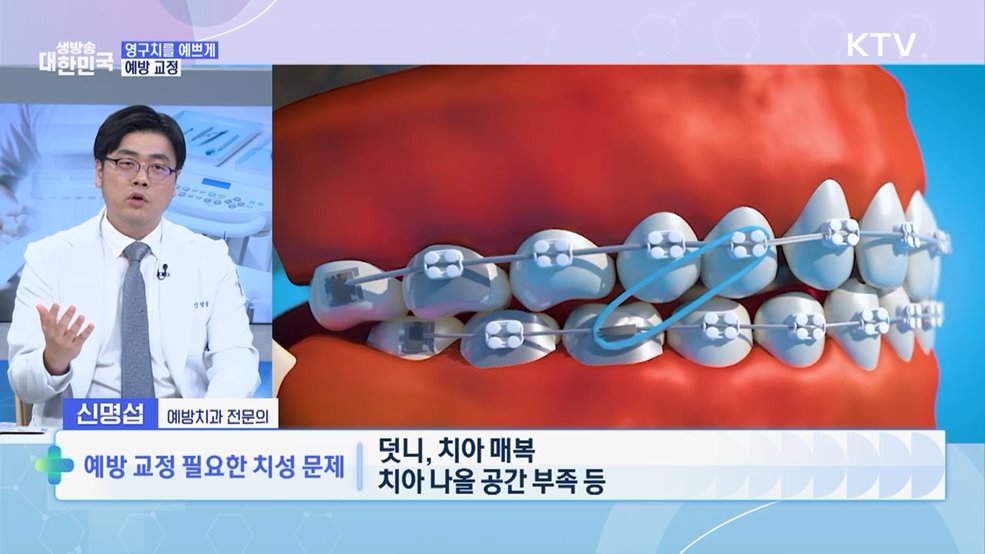 예쁘고 건강한 미소 치아교정 완벽정리 [건강 365]