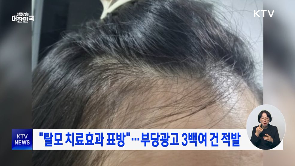 "탈모 치료효과 표방"···부당광고 3백여 건 적발