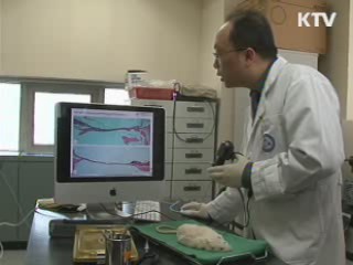 세계최초 '실크 인공고막' 개발 성공