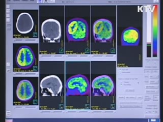 경남도, 저소득층 뇌질환 MRI 무료 검진 실시