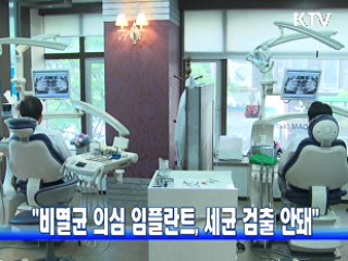 "비멸균 의심 임플란트, 세균 검출 안돼"