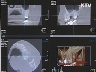 임플란트 과장광고 치과 21곳 적발