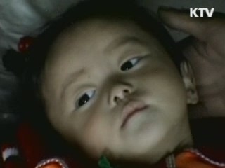 UN 보고서 "北 주민 3명 중 1명 영양실조