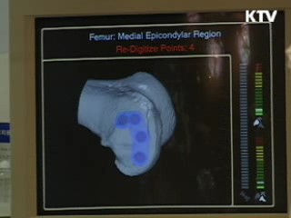 경기도, 로봇인공관절수술 지원