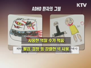 주의력결핍장애 10명 중 8명 남학생