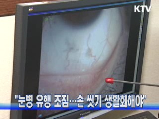 "눈병 유행 조짐···손 씻기 생활화해야"
