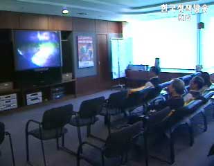 연금지급 기준 완화