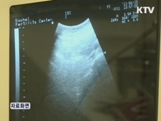 분만 무과실 의료사고 국가가 70% 보상