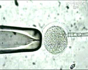 황우석 교수, 최고 과학자 지위 취소