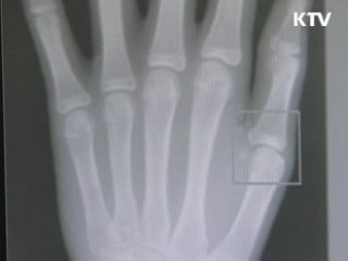 성(性)호르몬 발육기 성장 조절 가능