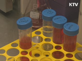 치매·척수손상 치료 가능성 높인 줄기세포 개발